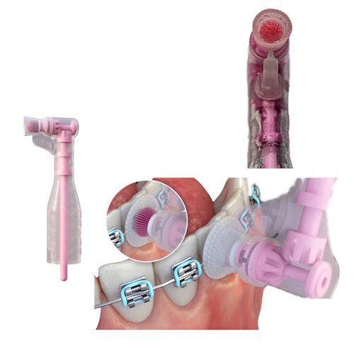 BUNDLE 3 + 1: <br>Lotus Ortho Brush Cup LSFAB-100 (Box of 100) - Image 3