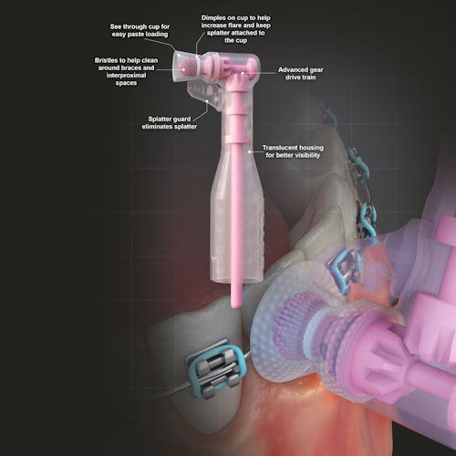 BUNDLE 3 + 1: <br>Lotus Ortho Brush Cup LSFAB-100 (Box of 100) - Image 4